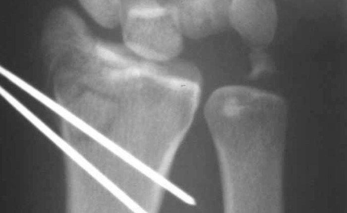 Conducting an Effective&nbsp;Postmortem